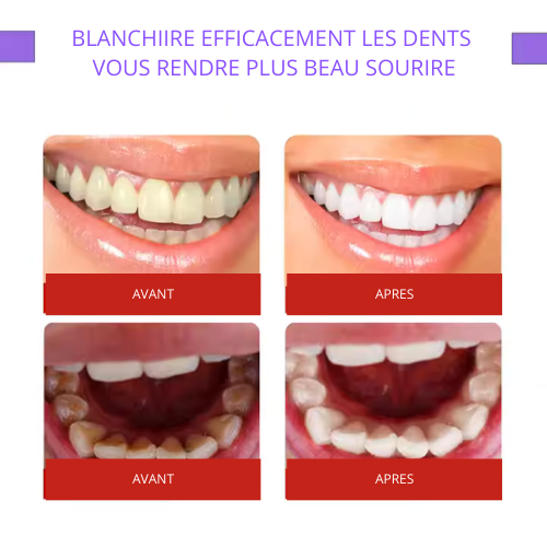 MEANSMILE v43 :Correcteur de Couleur pour des Dents Plus Blanches